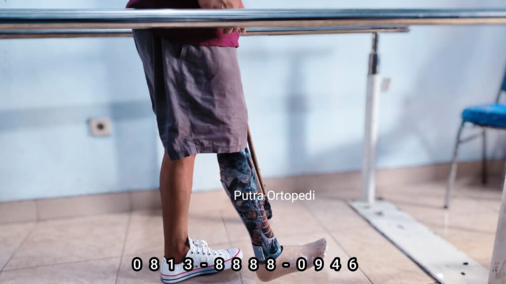 Jasa Pembuatan Kaki Palsu Custom