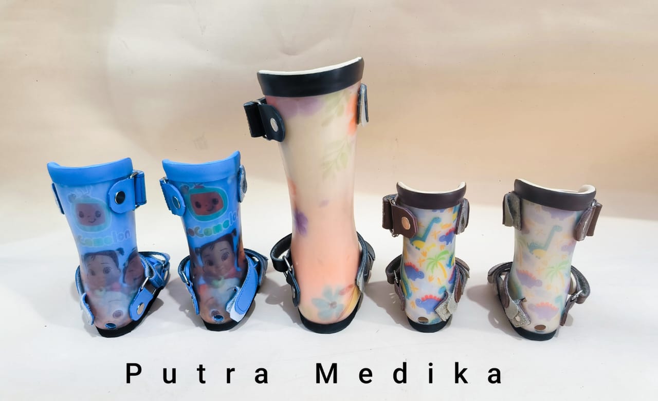 Jasa Pembuatan Sepatu AFO untuk Stroke dan Drop Foot