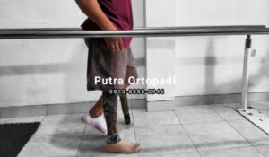 Pilihan Alat Bantu Jalan Orthopedi yang Nyaman Dipakai