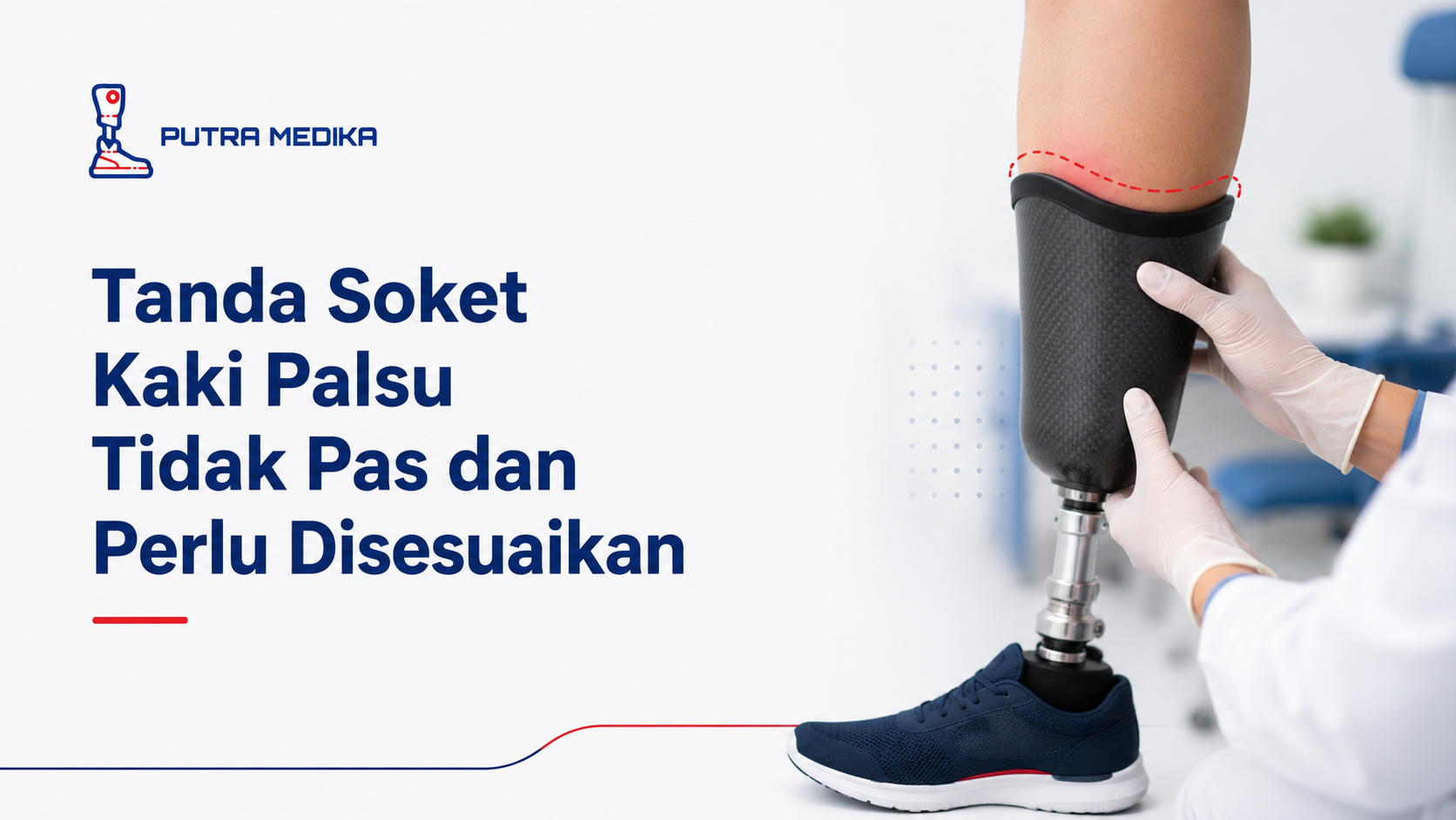 Tanda Soket Kaki Palsu Tidak Pas dan Perlu Disesuaikan