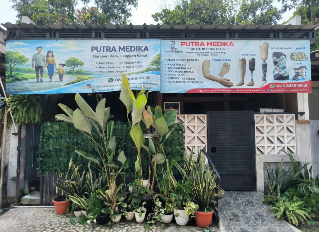 Tampak depan Klinik Putra Medika pusat layanan ortotik prostetik untuk pembuatan kaki palsu dan scoliosis brace