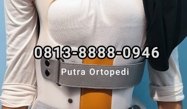 Scoliosis Brace (10)