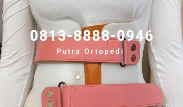 Scoliosis Brace (14)