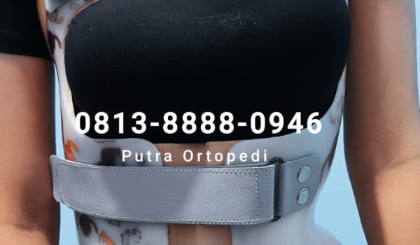 Scoliosis Brace (15)