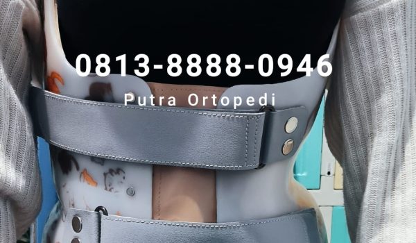 Scoliosis Brace (16)