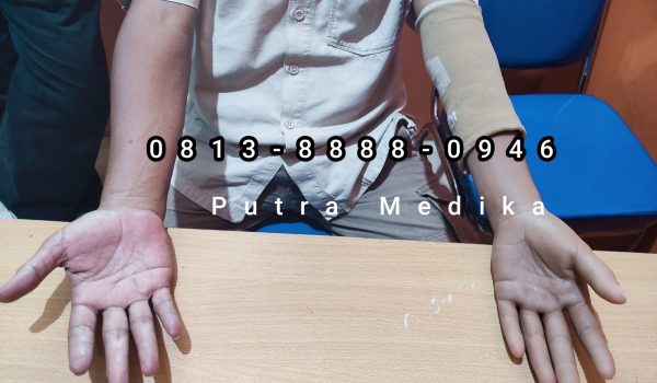 Tangan Palsu (11)